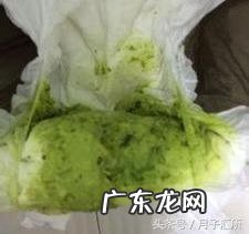 宝宝大便有点黑色 宝宝大便黑色颗粒
