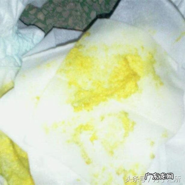 宝宝大便有点黑色 宝宝大便黑色颗粒