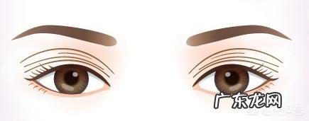 微创双眼皮手术一个月后眼皮变成了三层该怎么办?