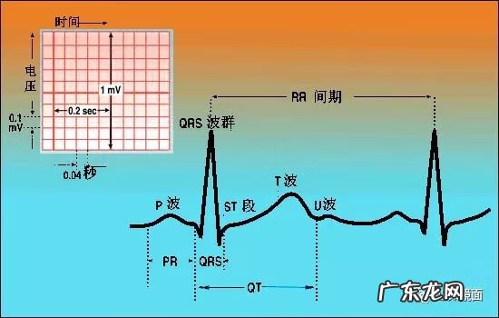 心电图导联的位置图片 心电图导联位置
