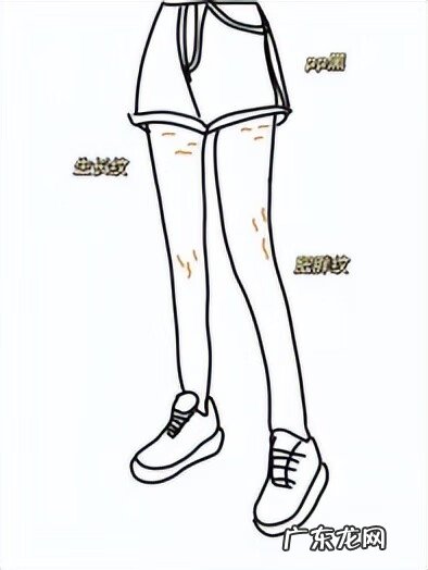 妊娠纹 去妊娠纹是什么原理