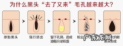 草莓鼻子是怎么形成的