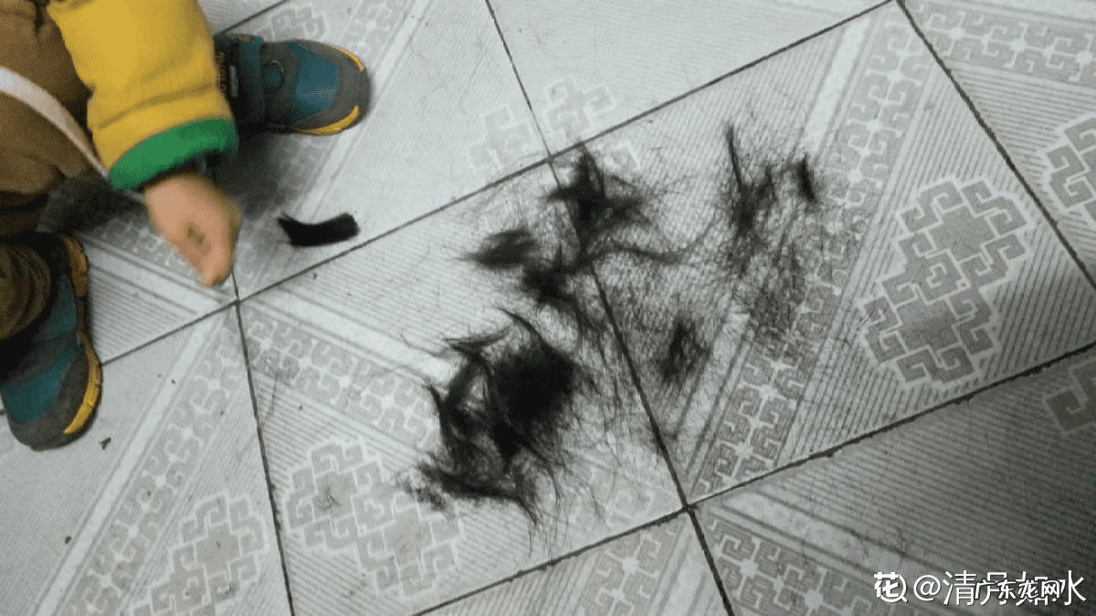 头发最近掉的厉害怎么办 头发掉的很厉害该怎么办