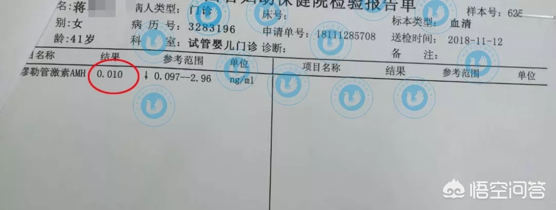 月经量少,是女人早衰信号?