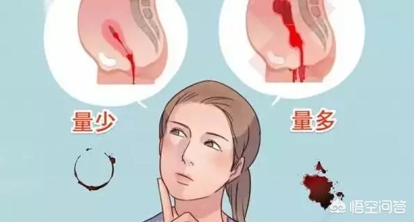 月经量少,是女人早衰信号?