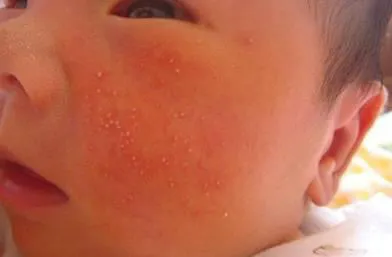 新生儿床上用品需要哪些 新生儿用品清单