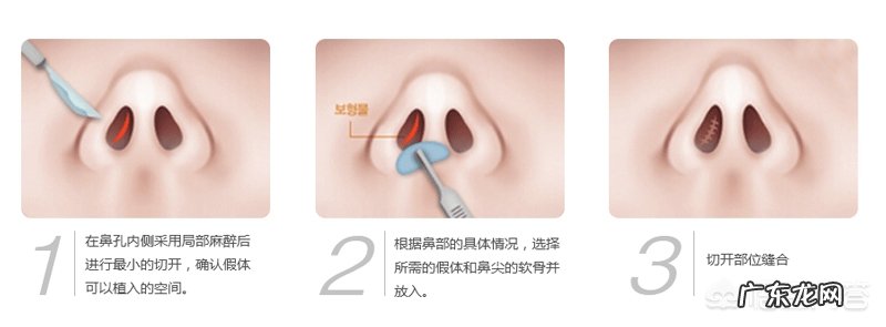 如何使鼻子更立体?