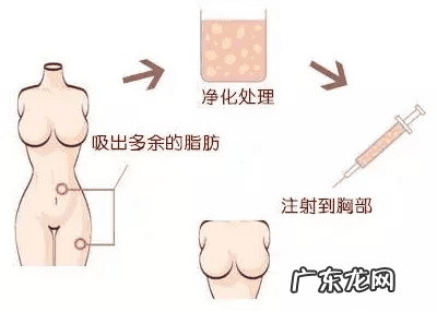 怎样让胸变得越来越大 明星怎么隆胸