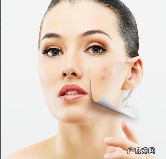 青春痘的治疗最佳方法 青春痘治疗的方法