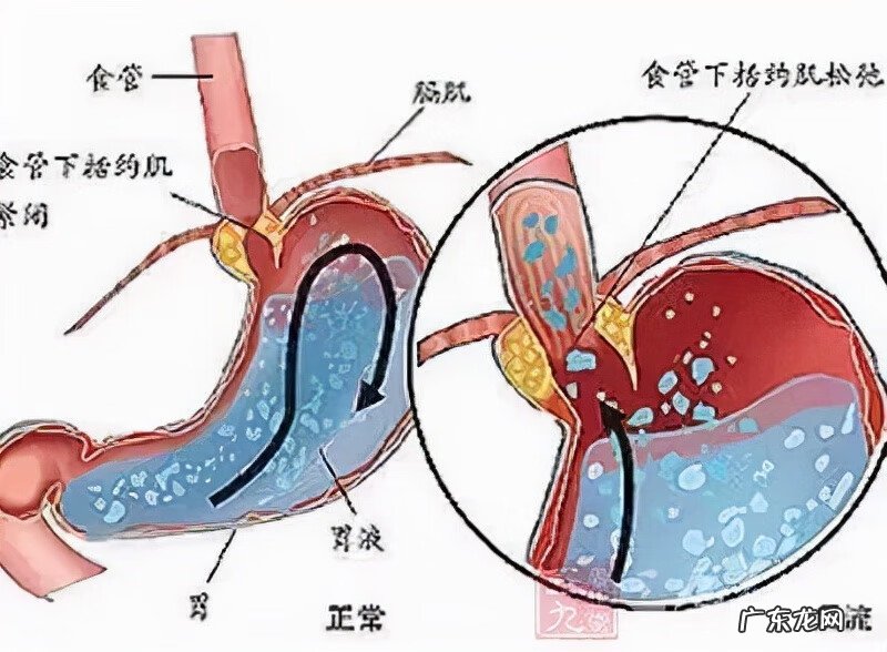 宝宝吃奶时老是吐奶头 宝宝吃奶时吐奶怎么办