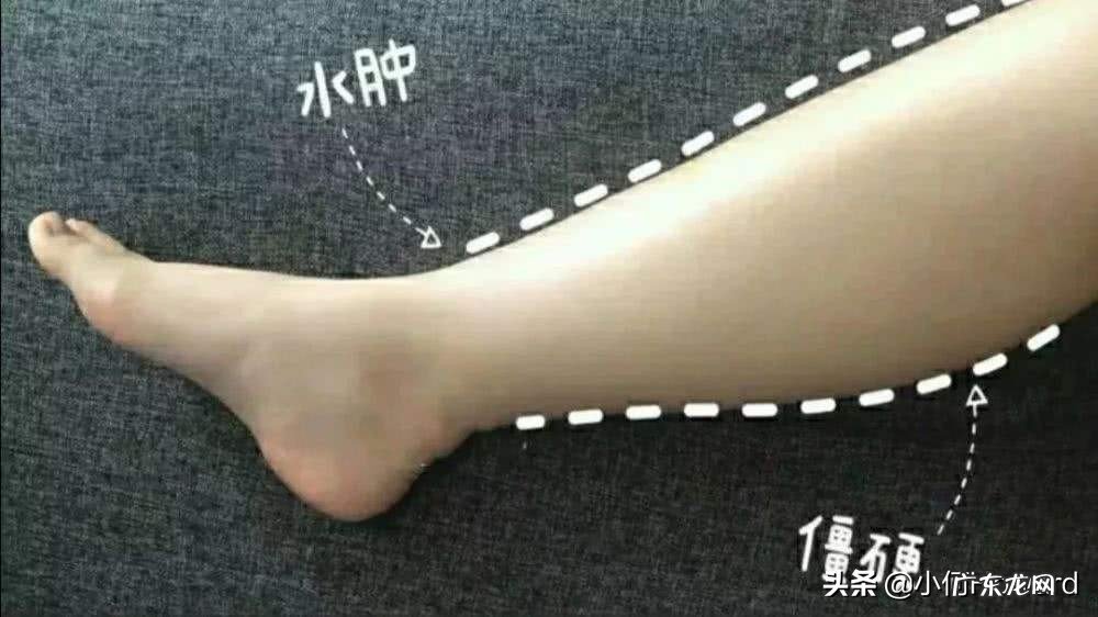 怎样才能瘦小腿肚子?