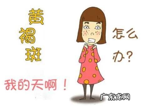 黄褐斑的形成原因及分类 黄褐斑的形成原因有哪些