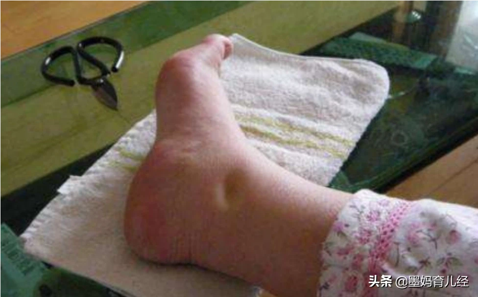 孕后期容易发生哪些问题？