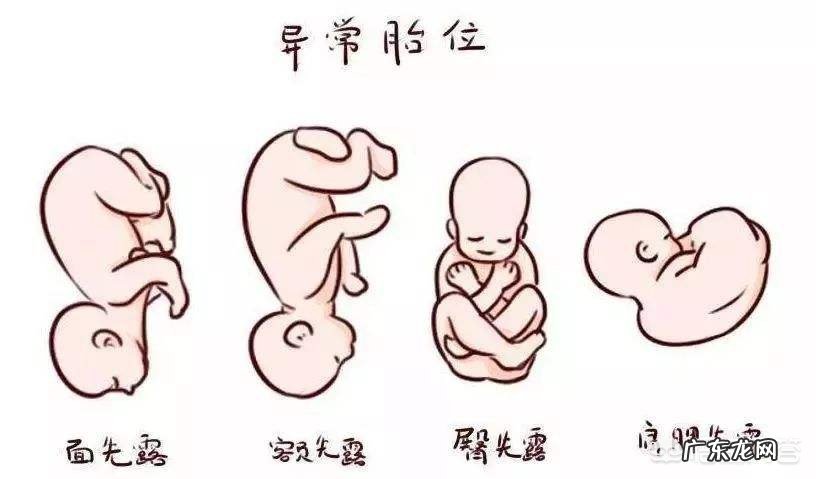 孕后期容易发生哪些问题?