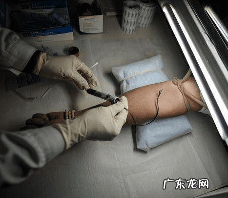 艾滋病的早期表现 艾滋病早期症状有哪些