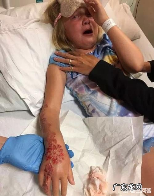 怎样快速美白晒黑的胳膊?