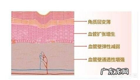 怎样快速美白晒黑的胳膊？