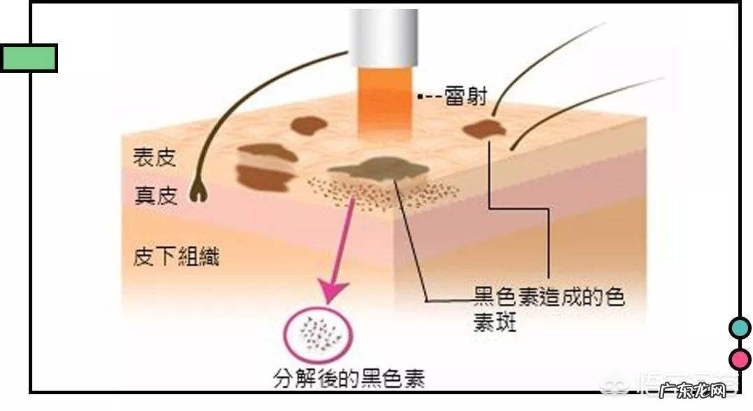 怎样才能又快又简单的祛斑?