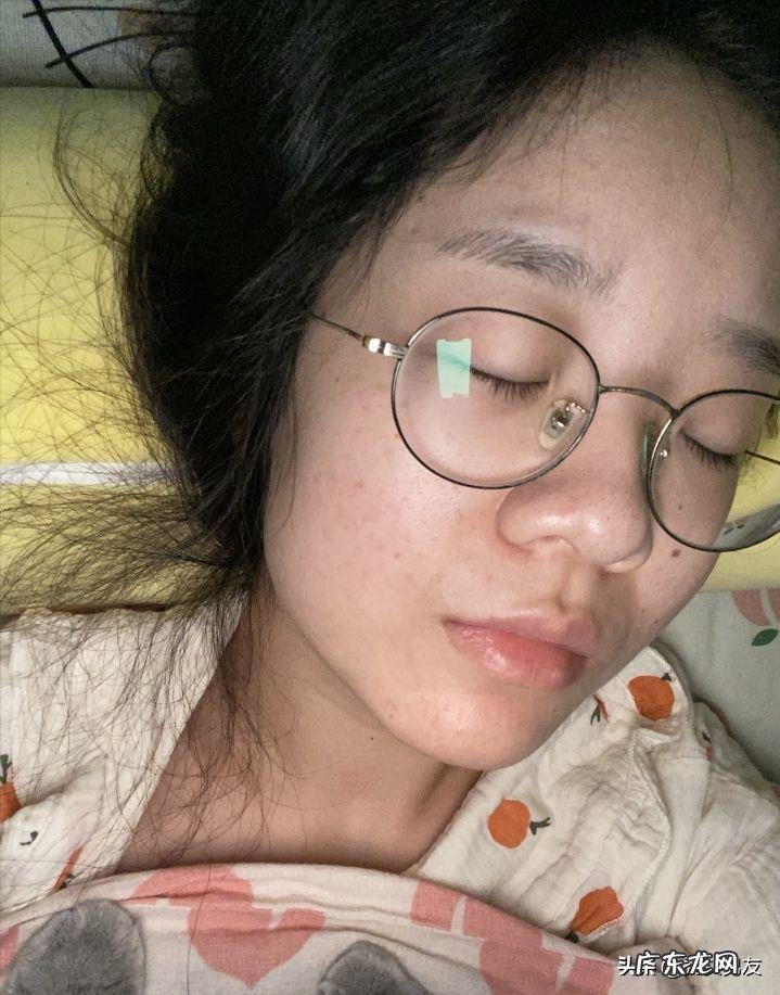 果酸换肤的作用是什么?