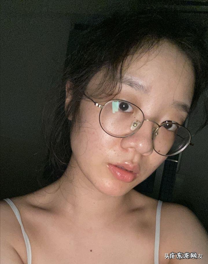 果酸换肤的作用是什么?