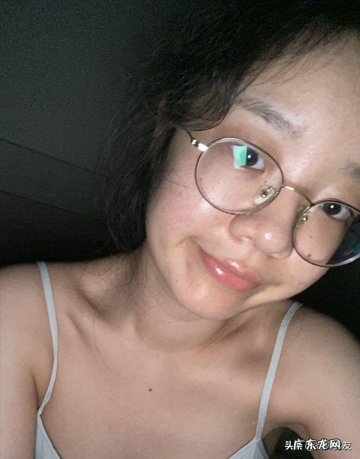 果酸换肤的作用是什么?