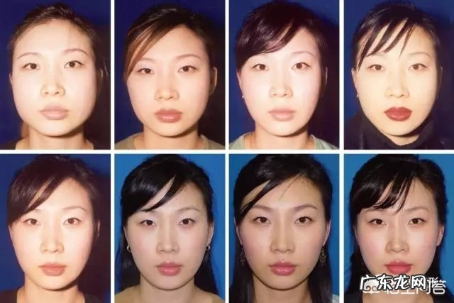 多久可以看出瘦脸针瘦脸的效果？