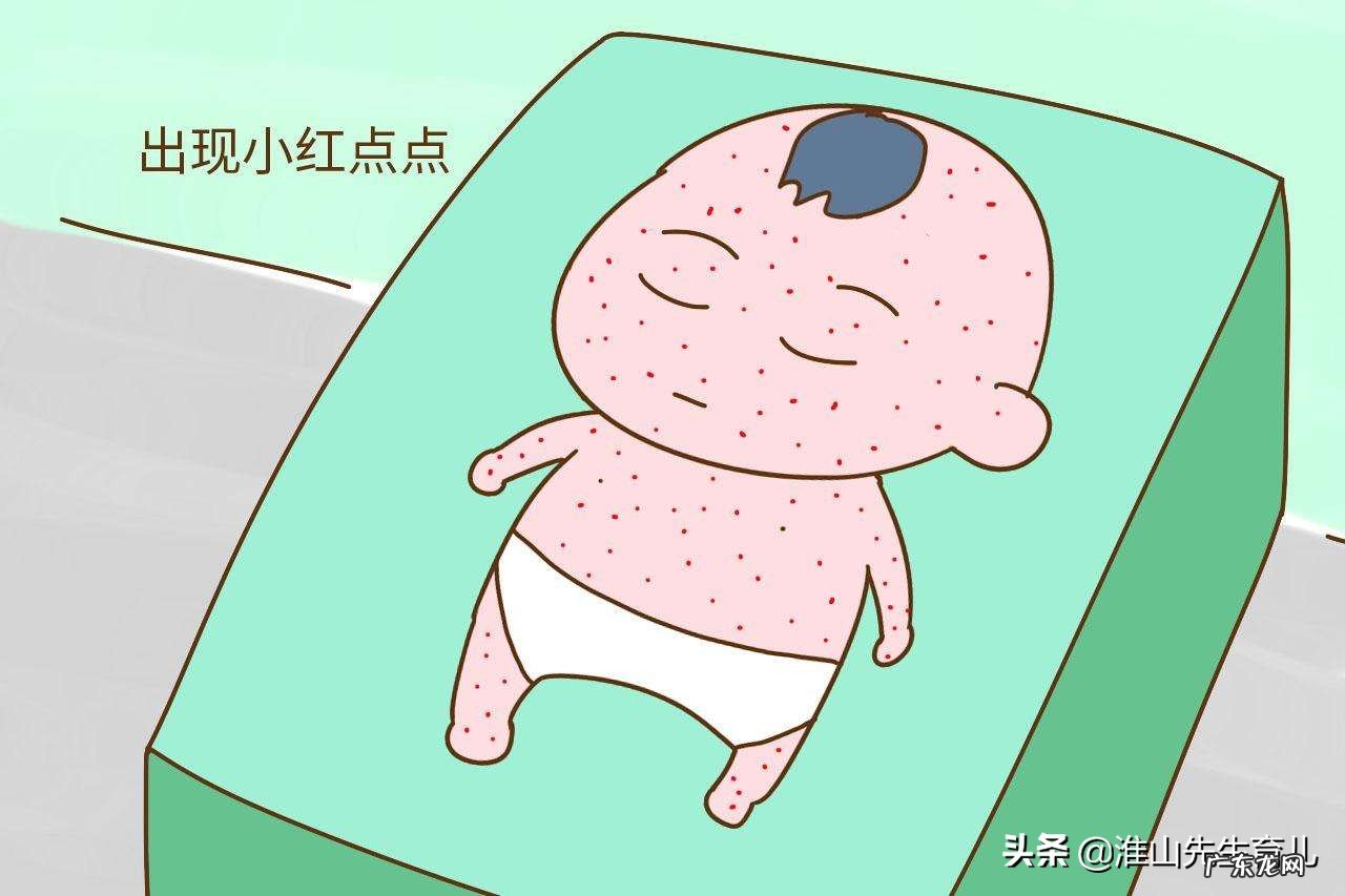 幼儿急疹的病症有哪些？该怎么缓解？