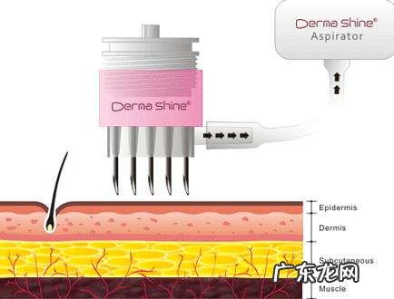 水光针的效果怎么样?你怎么看?