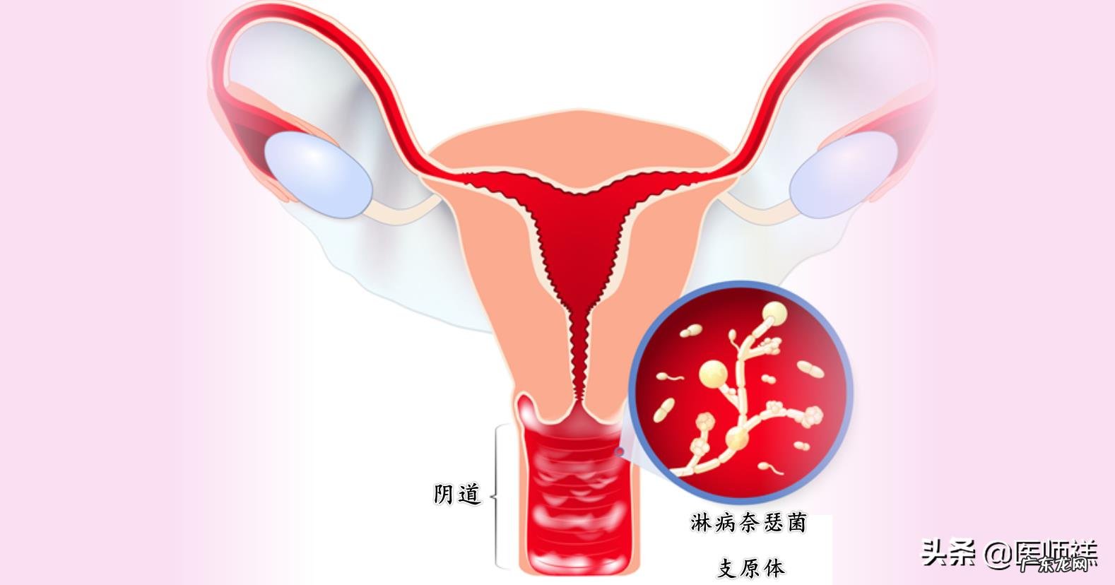 得了妇科疾病有哪些症状?
