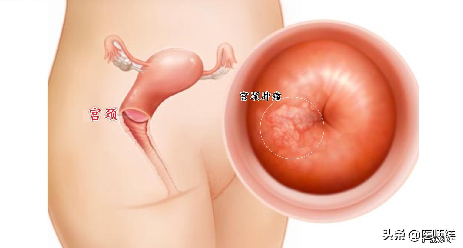 得了妇科疾病有哪些症状?