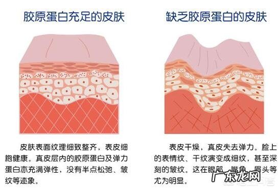 注射胶原蛋白除皱维持时间是多久?