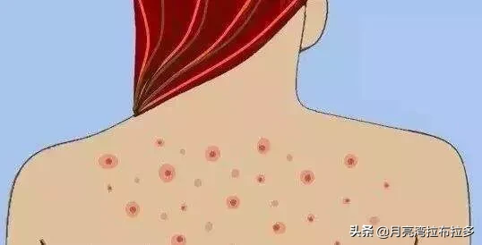 湿气缠身会有什么害处?怎么摆脱湿气?