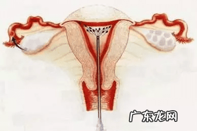 地下人工授精的过程与费用