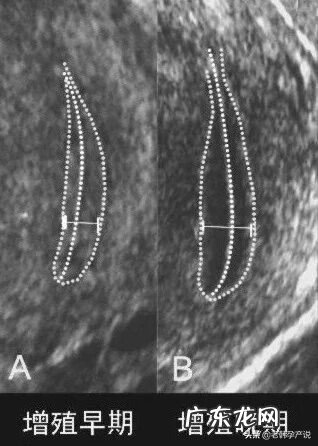 子宫内膜薄吃什么补得最快 子宫内膜薄吃什么食物好