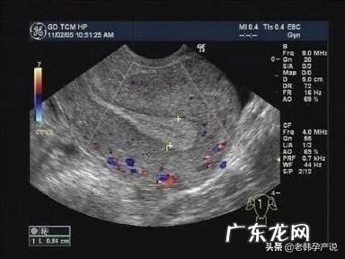 子宫内膜薄吃什么补得最快 子宫内膜薄吃什么食物好