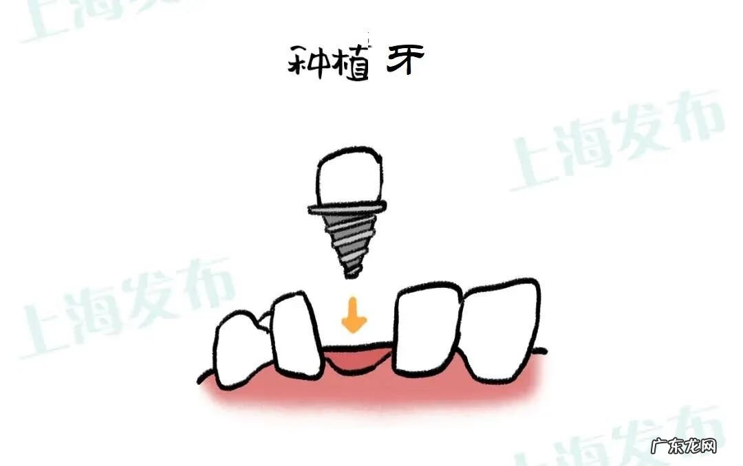 牙痛到神经痛怎么办 牙神经痛怎么解决