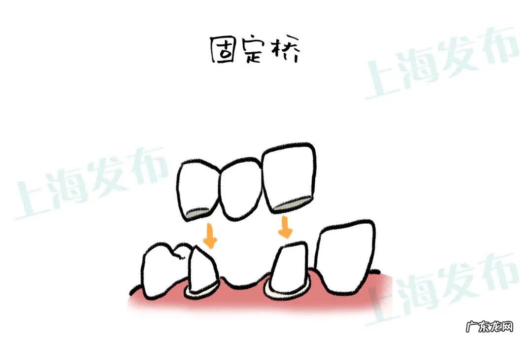 牙痛到神经痛怎么办 牙神经痛怎么解决