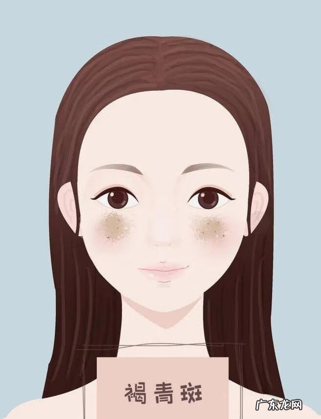 面部色斑是怎么形成的原因 脸上长色斑的原因是什么