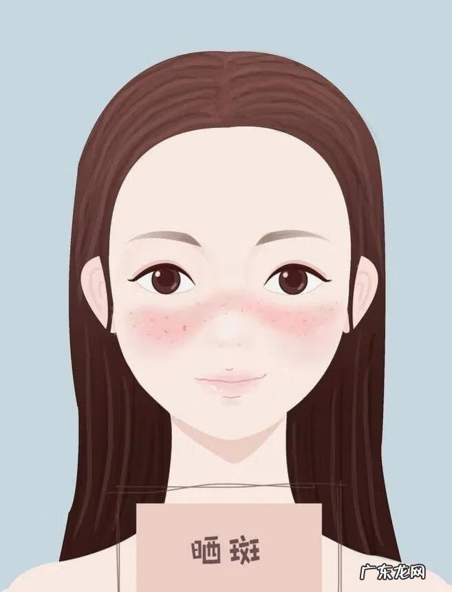 面部色斑是怎么形成的原因 脸上长色斑的原因是什么