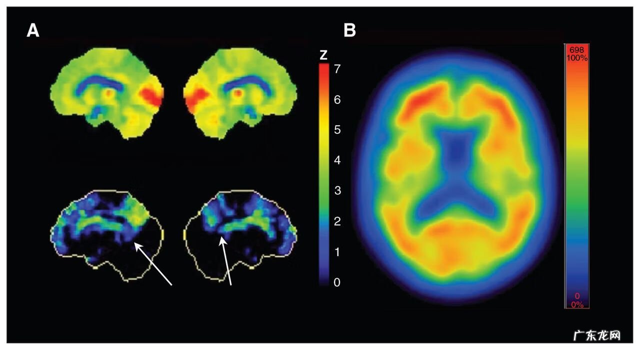 人的大脑如何开发 大脑开发程度
