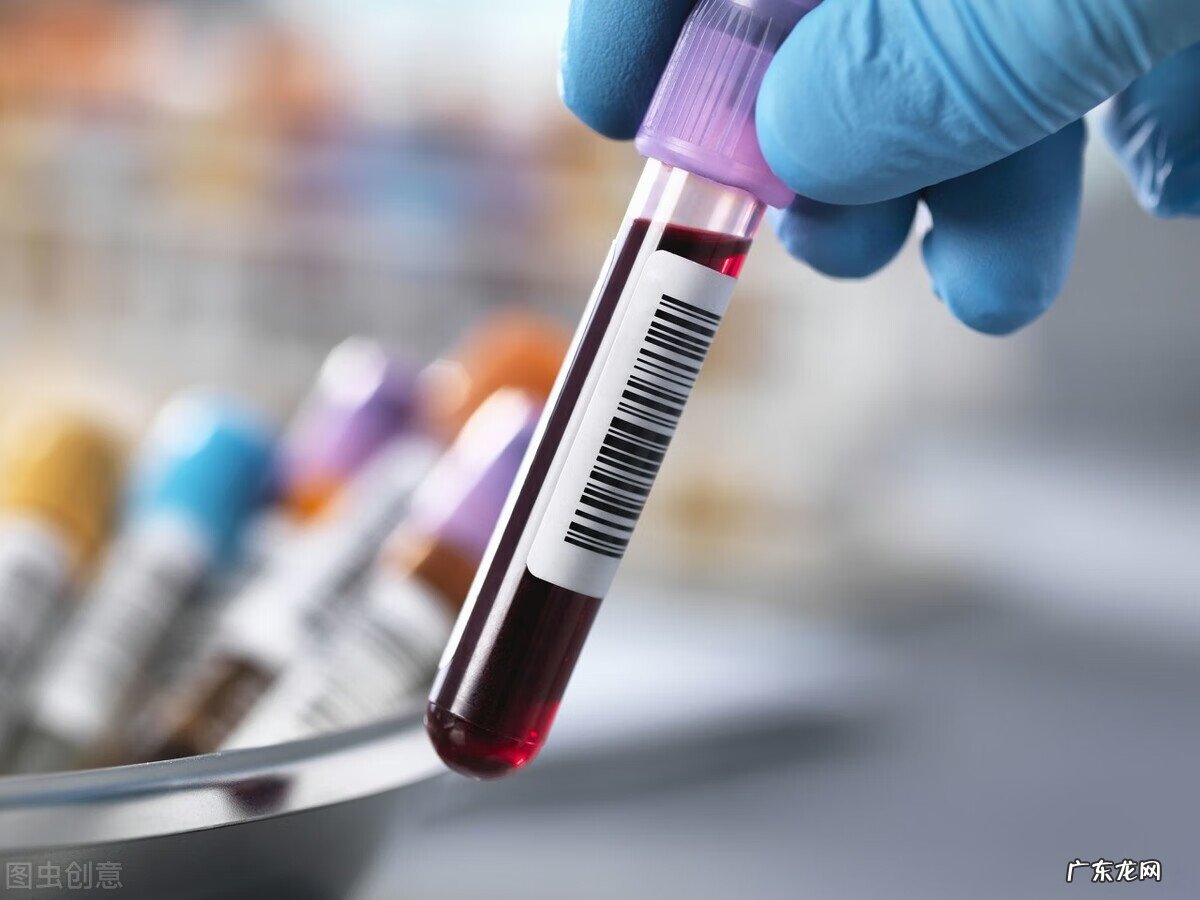 血脂高的人吃什么食物好 血脂高吃什么食物最好