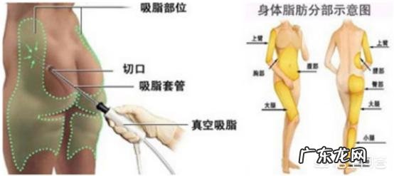 体型臃肿,主要表现在屁股和脸上,有什么有效方法可以缓解臃肿的部位?