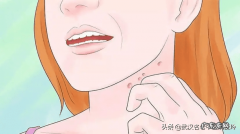 皮肤干燥粗糙是怎么回事