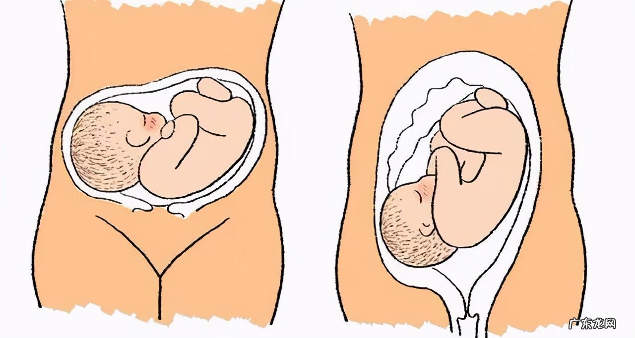 剖腹产日期如何选择 剖腹产的最佳时间是什么时候