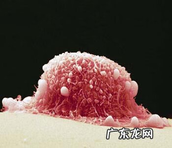 宫颈癌前病变能活多久 宫颈癌前病变是什么意思