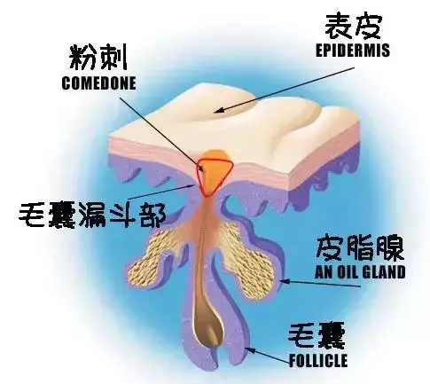 让毛孔变小最快的方法 毛孔变大的原因
