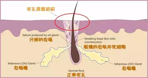 让毛孔变小最快的方法 毛孔变大的原因