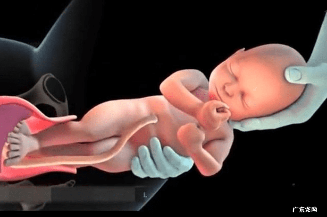 顺产是从哪个部位出来的 顺产是怎么样的?