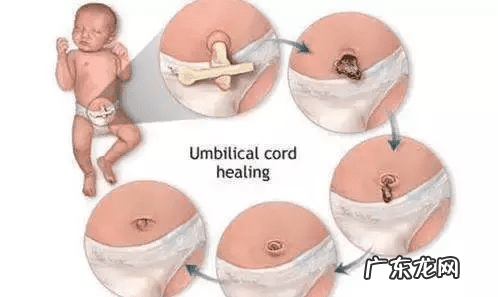 介绍一下您护理孩子的好方法 婴儿护理
