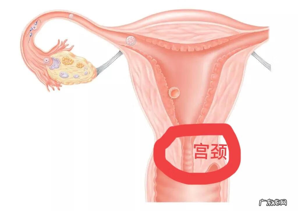 怀孕一个月怎么自然流产 怀孕一个月自然流产了怎么办